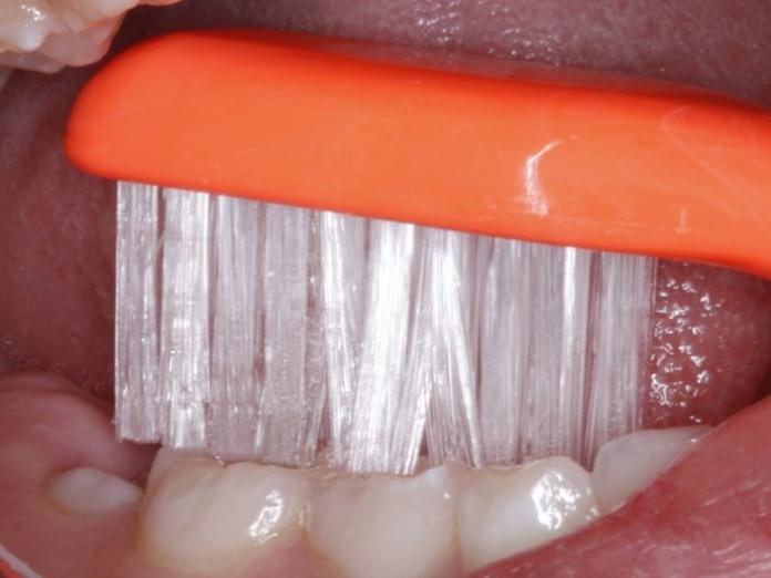 Billedet viser tand under frembrud, og at den ikke bliver børstet med tandbørsten.