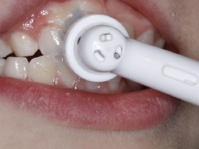 Billede viser tandbørstning med en elektrisk tandbørste