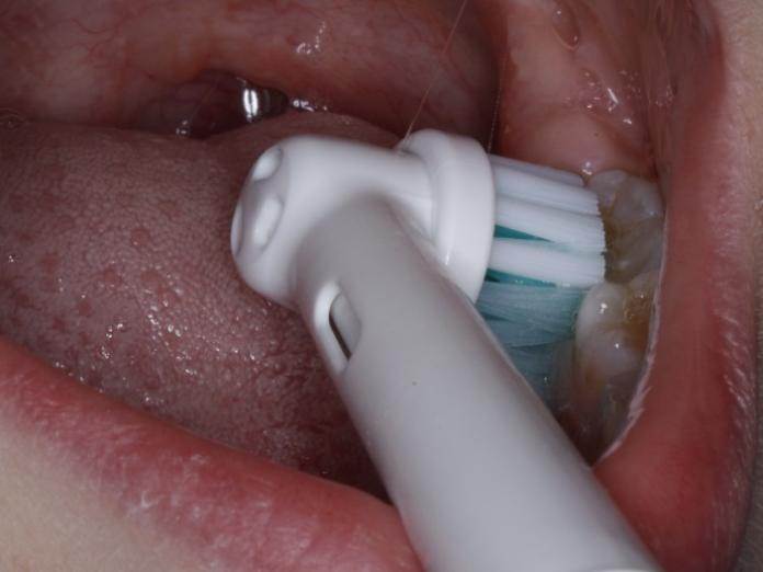 Billede viser tandbørstning med en elektrisk tandbørste