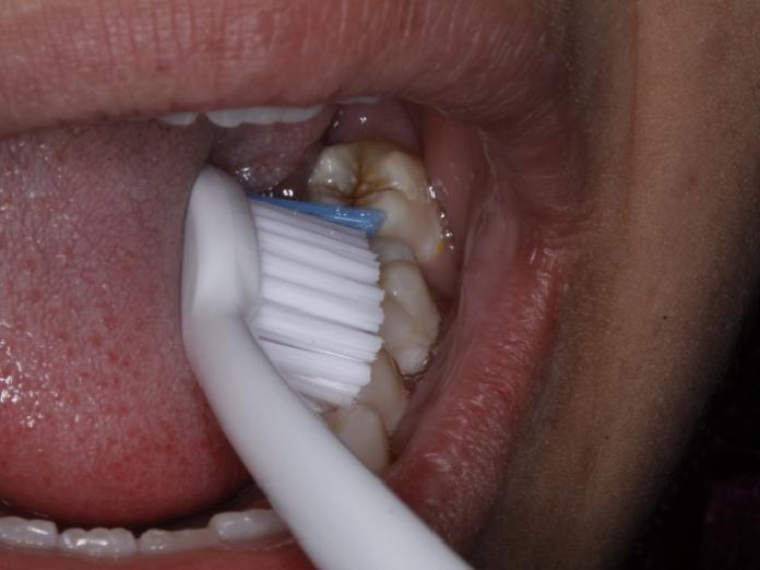 Billede viser tænder som er ved at blive børstet